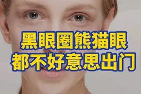 熊猫眼，黑眼圈严重，中医从补肾、化淤入手，效果非常快视频封面