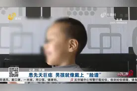 4岁半男孩患先天巨痣，家长看在眼里疼在心里，公益行动伸援手视频封面