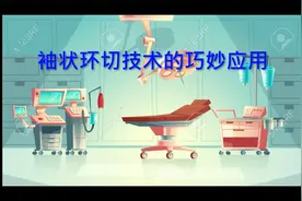 袖状环切手术 — 无痛、微创、美观、安心