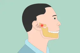 颞颌关节炎有什么危害？对生活的影响大不大？视频封面