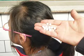 洗头时，在水里丢几粒阿司匹林，每个人都能用到，学会全家都受益