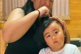 小晚晚夜里被毒蚊叮咬，肿成大小眼，这下出门都得戴墨镜了……