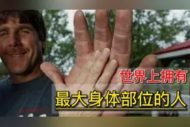世界上身体部位最大的6个人，真的是世界之大，无奇不有呀！视频封面