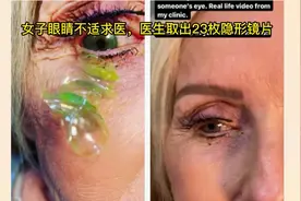 女子眼睛不适求医，医生取出23枚隐形镜片视频封面