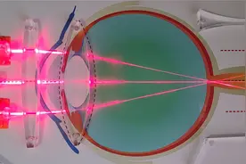 正常眼与近视眼、远视眼的区别！近视后不戴眼镜度数会加重吗？