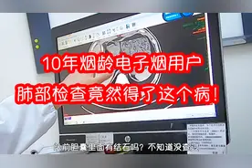 抽了10年电子烟，在医院做了肺部检查，结果竟然得了这个病！视频封面