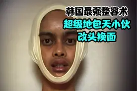 韩国最强整容术，超级地包天小伙改头换面变帅哥视频封面