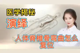 医学揭秘 人体脊椎弯曲变形怎么办 看医生如何利用机器修整复位视频封面