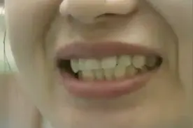 上下牙相互碰撞能保护牙齿？专家解释这叫叩齿 确实能够保健牙齿视频封面