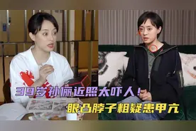 39岁孙俪近照太吓人！眼凸脖子粗被疑患甲亢，养生方式引争议视频封面