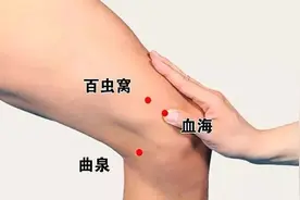 荨麻疹发作，浑身瘙痒，刺激大腿上的“百虫窝穴”，祛风、止痒