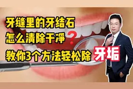牙缝里的牙结石怎么清除干净？教你3个方法，轻松除牙垢视频封面