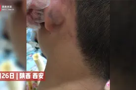 西安13岁女孩控诉父亲殴打自己和弟弟：揪衣领 扇耳光 用脚踢视频封面