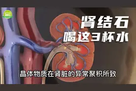 肾结石的“克星”已找到！喝这3杯水，排出结石，不给肾脏添麻烦视频封面