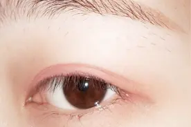 专家在线解疑：眼睛有黄色斑点是怎么回事？需要治疗吗？视频封面