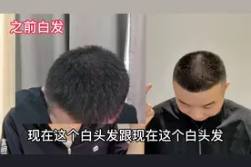 37岁的帅哥护理头皮一个月时间了,这个白发又有多少改变呢视频封面