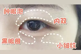 眼睛肿了怎么办？2分钟徒手眼部按摩操，改善浮肿去除眼皮脂肪