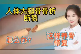 医学演绎 人体大腿骨折骨裂 如何修复  看医生如何实操视频封面