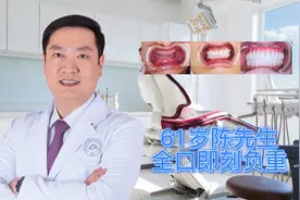 种植牙案例：61岁陈先生牙齿掉光了，上4下6做全口即刻种植牙视频封面