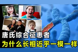 为什么唐氏综合征患者，长着几乎一样的脸？该如何预防这种疾病？