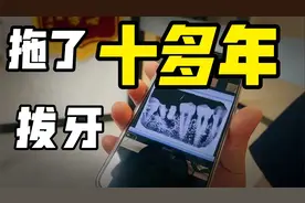 完整记录拔牙过程，胆小勿入。牙龈问题千万别拖，尽快去找医生视频封面