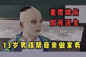 13岁男孩帮妈妈做家务，却没想被大火重度烧伤，全身上下被烧焦黑