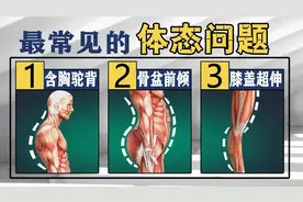 体态评估，体态问题初级站立评估法，常见体态问题合集视频封面