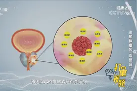 得了前列腺癌，如何治疗？专家讲解几种不同治疗方法|健康之路视频封面