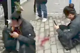 看着就疼！重庆一男子走路看手机撞上电线杆，眼镜片破碎刺破眼球