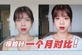 瘦脸针一个月对比！雯雯打了瘦脸针之后，惊喜发现效果很好变美了视频封面