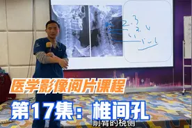 颈椎X光侧位片主要看椎间孔，李医生从椎孔狭窄结合临床全面分析