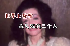 脸部畸形，口齿不清！世界上整容最失败的三个人，悔不当初！