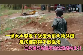 非洲流浪儿童三兄弟，大火夺走父母，哥哥腿严重烧伤得不到医治视频封面