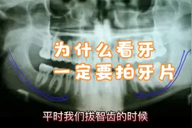 牙片怎么看？拔牙补牙为什么要先拍片子？怎么看牙神经，蛀牙呢？
