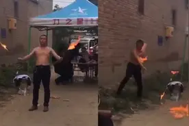突发！保定1男子表演喷火时出现失误，脸被严重烧伤看着都疼