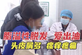 高中生因为学习精神压力大导致脱发严重，中医：不要天天洗头