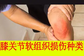 膝关节病中不同的软组织损伤各有什么表现，如何诊断很重要