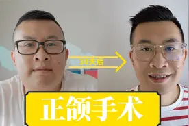 我换头了？正颌手术30天全记录！