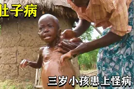 纪录片：非洲三岁小男孩从小患上怪病，肚子肿大犹如怀孕一样！视频封面