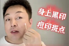 药房见到这个“小软膏”要拿下，每天涂两次，皮肤黑印轻松去视频封面