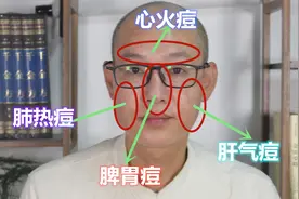 过了长痘的年龄，还长痘！是什么原因？长的位置不同，问题不一样视频封面