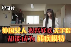 外国女人双腿截肢没有手指，却能成为残疾模特，鼓励粉丝热爱生活视频封面