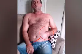 医生将男子断手缝进胃里，接下来几个月，发生的事让人瞠目结舌视频封面