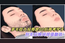 多毛症大叔竟是高考学子！不仅满脸络腮胡，眉毛长得还有个性