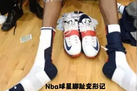 Nba球星脚趾变形记 --这样的脚脚你爱了吗？饭还香吗视频封面