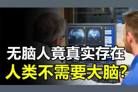 “无脑人”竟真实存在，难道人类可以不需要大脑？视频封面