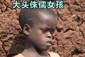 非洲纪录片：大头侏儒女孩6岁才会爬，母亲独养6子，竟有奇迹出现视频封面