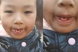 口吐莲花！河南一女孩现神奇天赋“莲花舌”，吐舌下一秒成三瓣