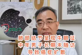 患者检查发现肺部有个牛眼征结节，但没有经常随访，现在后悔莫及视频封面