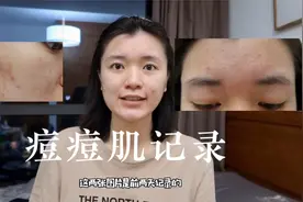 去皮肤医院花447.7元真的能把痘痘治好？！